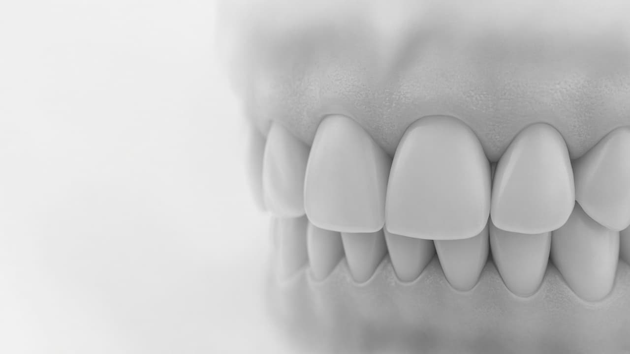 Consulta por encías sangrantes y gingivitis en Mar del Plata