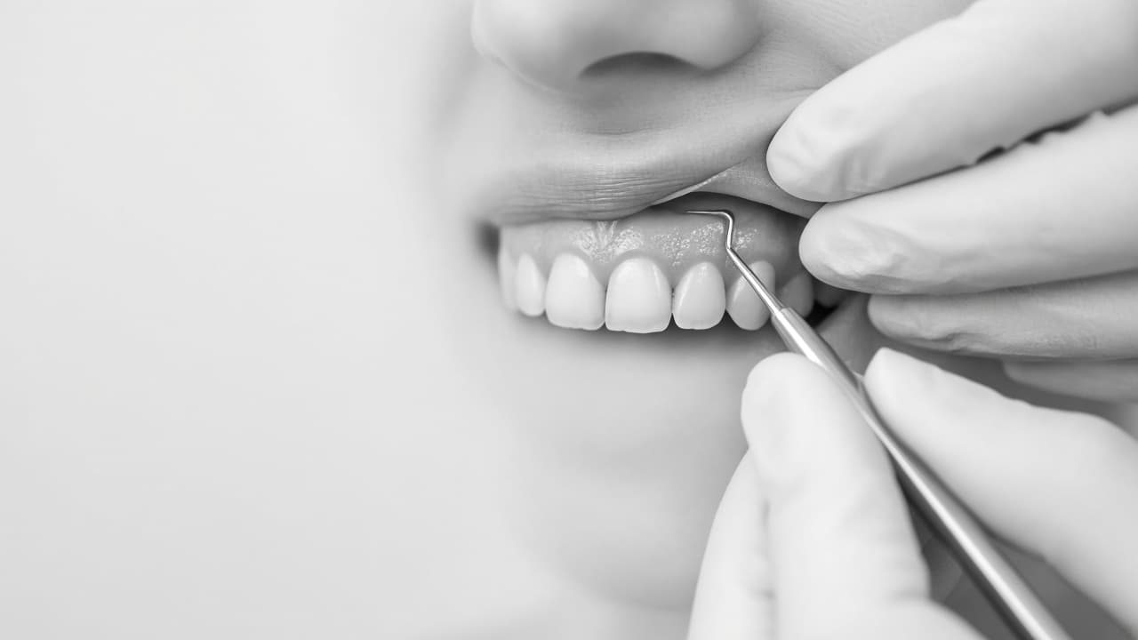 Cirugía periodontal y de encías en consultorio de Mar del Plata